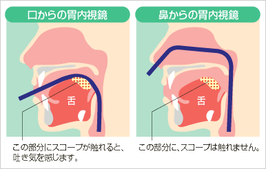 経鼻内視鏡